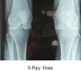 X-Ray Knee